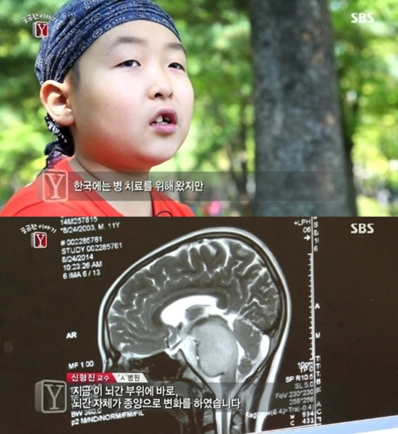 10살 리틀싸이 전민우의 6개월 시한부 사연에 '눈물샘'