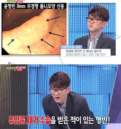 윤형빈, 대장암 위험 "담배 피면 벌금 500만 원 내겠다"