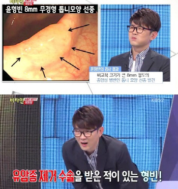 윤형빈, 대장암 위험 "담배 피면 벌금 500만 원 내겠다"