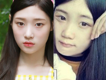 다이아 정채연 '성형설', 고교 동창 과거 사진 공개 "코만 했다"
