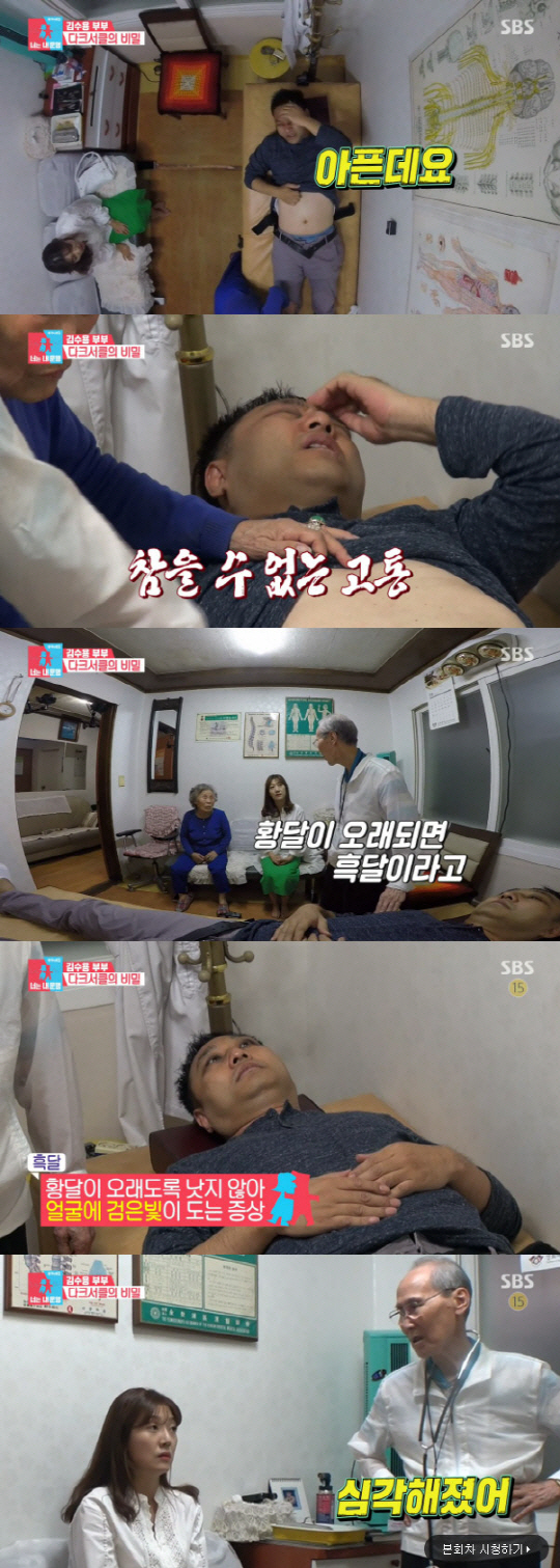 `수드래곤` 김수용, 다크서클 비밀 밝히고 `동상이몽2` 하차