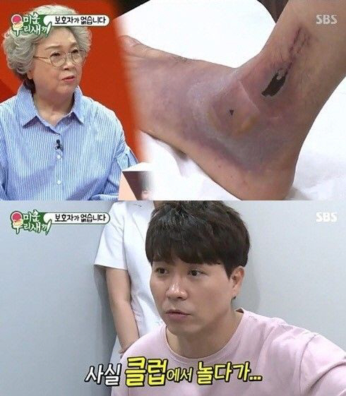 '이제 곧 쉰살'…박수홍이 진단받은 '봉와직염'이 뭐길래?