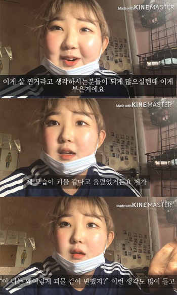 '루프스병' 최준희 "괴물 같이 변해.." 어떤 증상 있나?