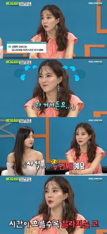 '비스' 김나희 "코 성형 두 번 했다..시간 지나니 점점 변해"