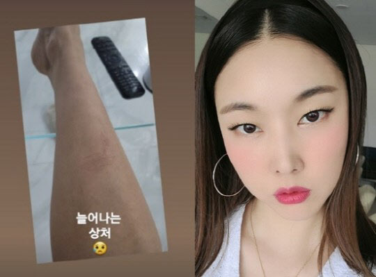 모델 한혜진, 코로나19 확진…방송가 비상