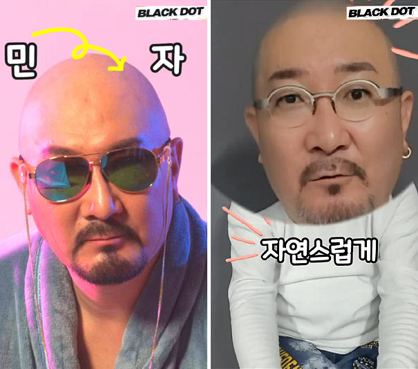 컬트빌리, 두피문신으로 회춘한 근황 공개