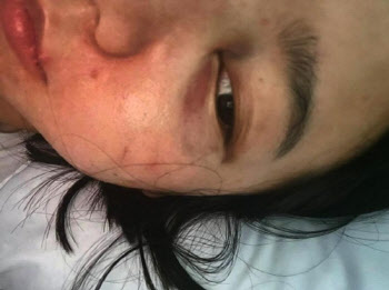 서사랑 "분노조절 장애 남편이 구타"…이정환 “아내, 만취상태”