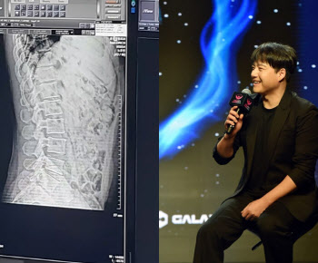 노유민 "엉덩방아 찧어 기절, 아내 없었으면 큰 일 날 뻔"[직격인터뷰]