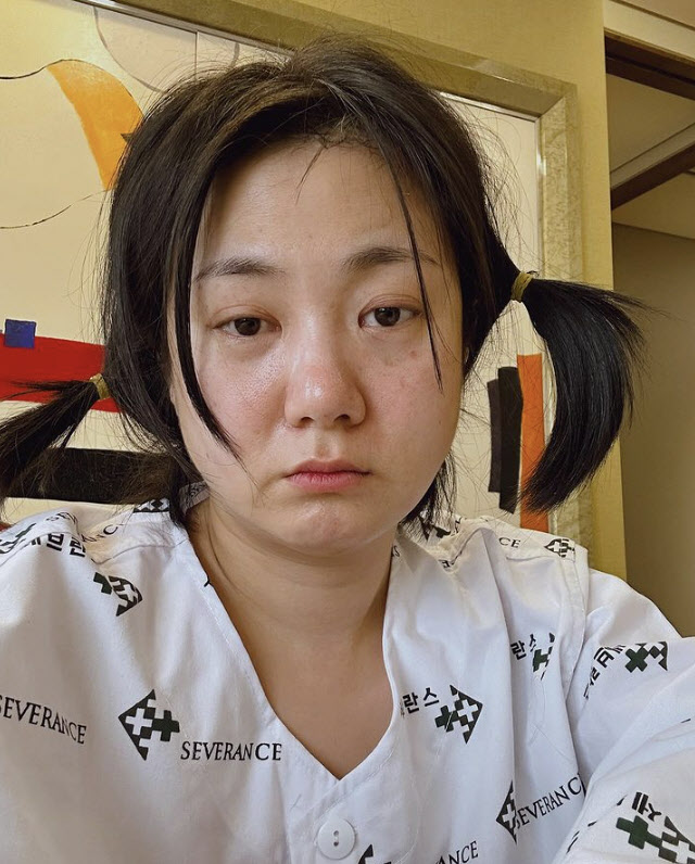 '나혼산' 불참 박나래, 성대수술 받았다…"성형수술 아냐"