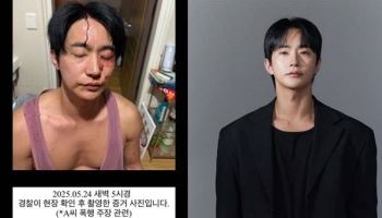 “폭행하고 성병 옮겼다”vs피투성이 얼굴…뮤지컬배우 전호준 폭로전