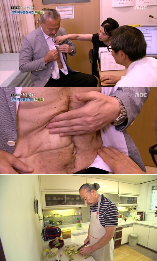 전설의 레슬러 이왕표, 3차례 담도암 수술..몸무게도 36Kg 줄어