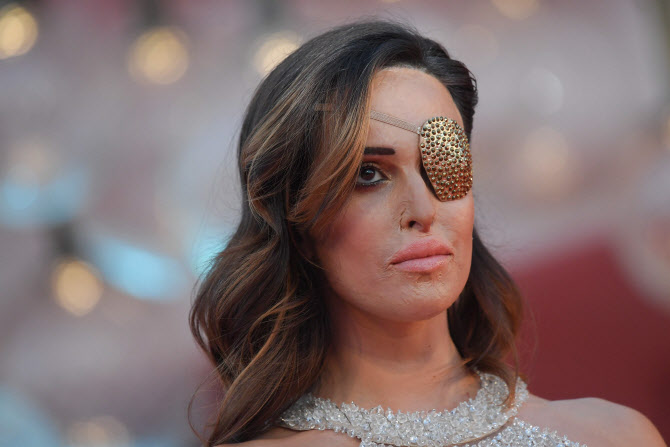 제시카 노타로, '황산 테러 극복' 베니스 영화제 참석                                                                                                                                            