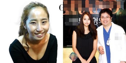 `슈스케2` 최은, 양악수술로 `청순미인` 변신 화제